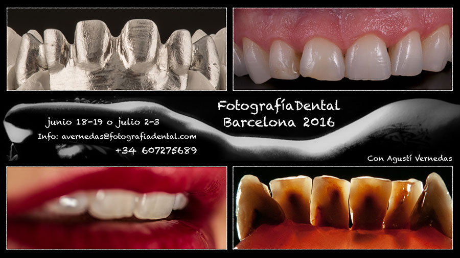 curs-foto-dental-bcn-2016-06-01.jpg
